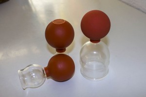 Sugekop2